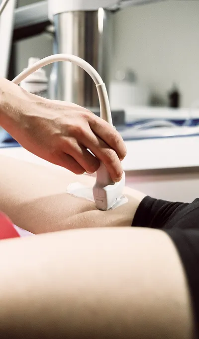 Sonovein Behandlung 2